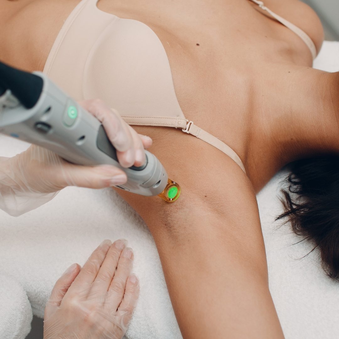 Laser Hair Removal for Darker Skin in St. Paul & Roseville, MN