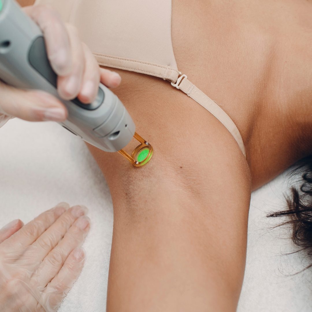 Bikini Line Laser Hair Removal Treatments Christina Clinic