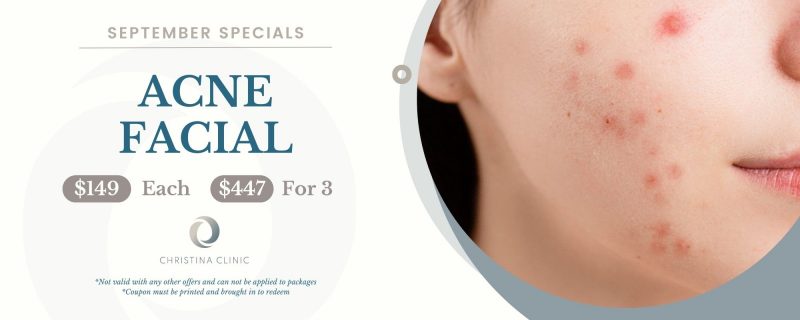 Christina Clinic Acne Facial special